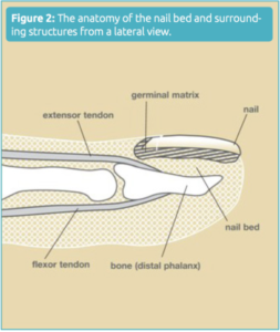 trauma nail treatment